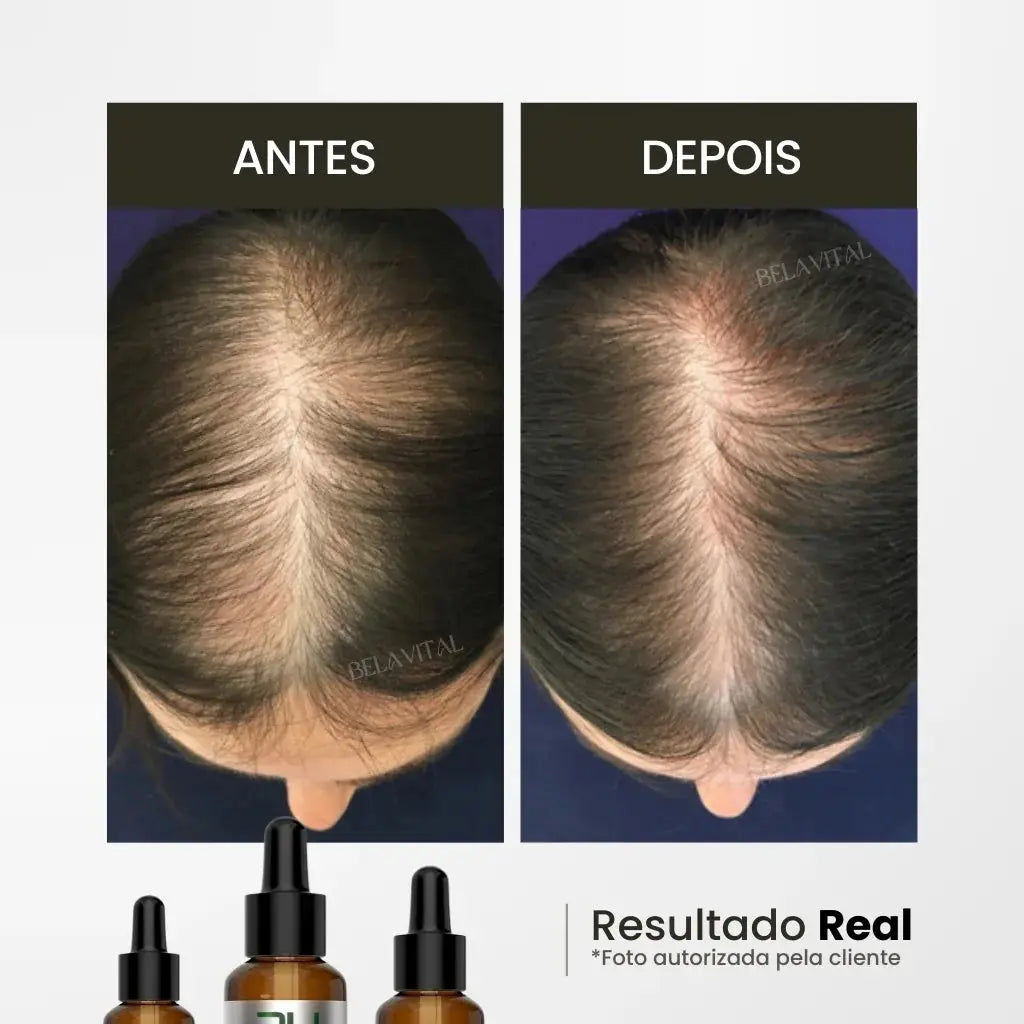 Óleo de Alecrim: Crescimento e Fortalecimento Capilar Bela Vital