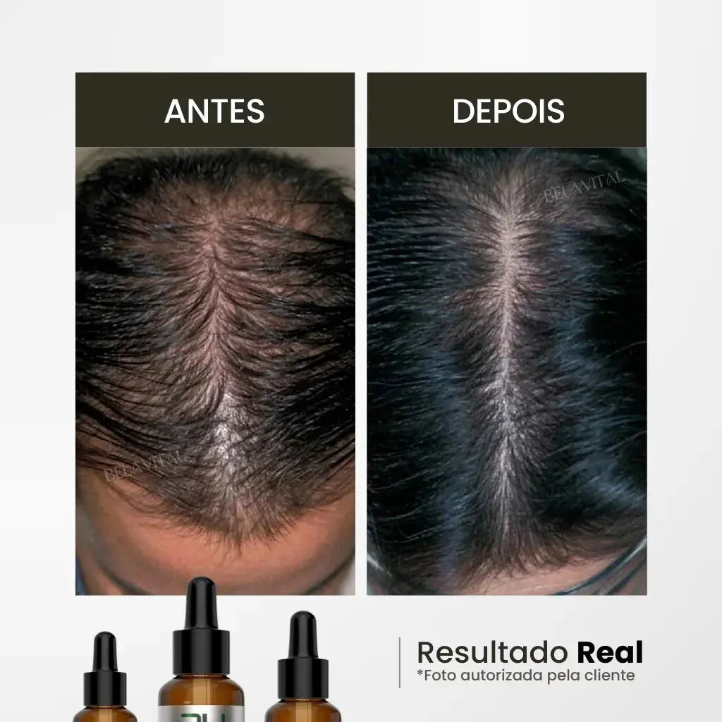 Óleo de Alecrim: Crescimento e Fortalecimento Capilar Bela Vital